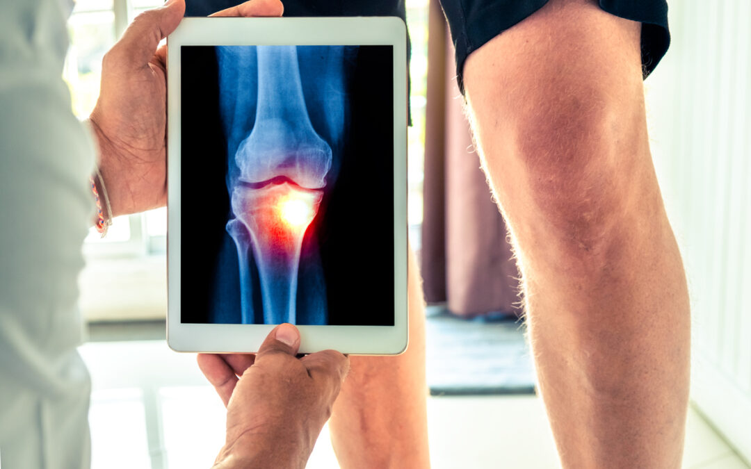 How to Adapt Your Home Technology for Living With Arthritis